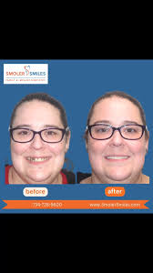 Bruce Smoler (@drbrucesmoler) • Instagram photos and videos