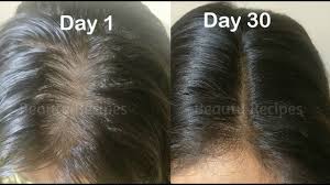 Pin On Hair