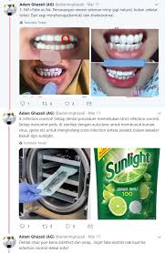 Untuk melakukan veneer gigi, kami menyarankan untuk melakukan konsultasi terlebih dahulu. Tu Gigi Ke Mentos Hati Hati Trend Veneer Instagram Dentist Perjelas Risiko Gigi Yang Pakai Fake Veneer Lobak Merah