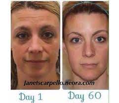 Pin On Anti Aging Skin And Wellness Care