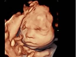 Hull mums can now get baby gender revealed just six weeks into pregnancy