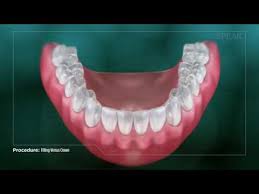 We did not find results for: Klinik Pergigian Dr Karthi In Ipoh Malaysia Read 6 Reviews