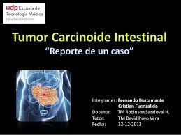 Se localiza principalmente en el tracto gastrointestinal. Tumor Carcinoide Presentacion De Un Caso