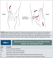 Image result for Knee Bulge Sign