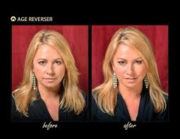 Before And Afters Using The Instant Facelift Band By Age Reverser Www Thefaceliftband Com Instant Face Lift Facelift Best Face Products
