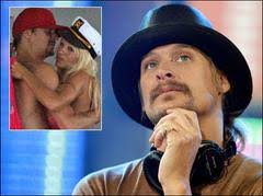 Kid Rock disser Pamela