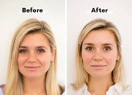 How To Get Rid Of Dark Circles 6 Different Ways Dark Under Eye Undereye Circles Dark Circles Under Eyes