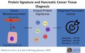 Pancreatic cancer is the most aggressive, least treatable form of the disease, and in a large majority of cases it reduces the victim's life expectancy to a matter of months. Protein Signatures And Tissue Diagnosis Of Pancreatic Cancer Journal Of The American College Of Surgeons