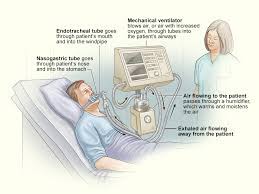 If someone has built up a tolerance to a drug, it tends to metabolize more quickly. Ventilator Ventilator Support Nhlbi Nih