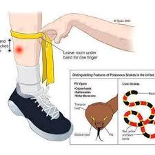 Snake Bites Symptoms Symptoms Depend On The Type Of Snake But May Include Snake Snake Bites Poisonous Snakes