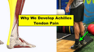 Check spelling or type a new query. How We Develop Achilles Tendon Pain Squat University