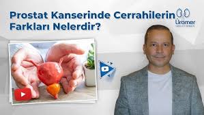 What are the Differences of Surgery in Prostate Cancer?