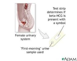 Is your period late or do think you might be pregnant? Pregnancy Test Medlineplus Medical Encyclopedia Image