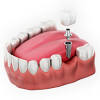 33 reviews of pure dental i'm a new patient but my two visits were excellent. 1