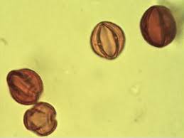 Image result for Maprounea