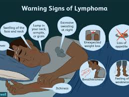 Lymphoma can sometimes cause an itchy rash. Lymphoma Signs Symptoms And Complications