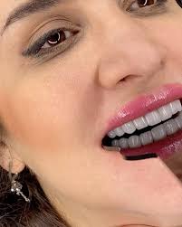 Dr Jafarpour (@drjafarpour) • Instagram photos and videos