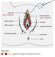 Zachęcamy do zapoznania się z innymi modelami filtrów fazy lotnej. Sexual And Reproductive Health Screening During The Domestic Medical Examination For Newly Arrived Refugees Immigrant And Refugee Health Cdc