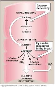 Image result for Lactase Deficiency