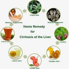 Cirrhosis isn't curable, but it's treatable. Home Remedies For Cirrhosis Of Liver Home Remedies Home Remedies Remedies Cirrhosis