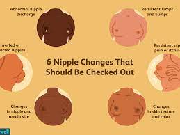 Nipple And Areolar Changes What S Normal What S Not