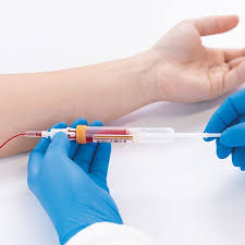 Image result for Venous Blood Sampling