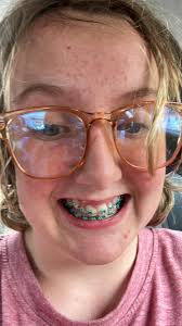 I get braces soon, does anyone know what I should do before and after, also  like what foods are the best to eat and what things should I buy while  having braces