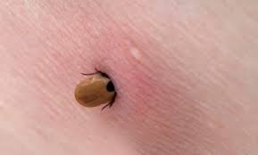 Jun 09, 2021 · si beaucoup de belges connaissent la maladie de lyme, transmise par la tique, peu connaissent pourtant les autres pathologies qu'ils peuvent encourir en cas de morsure. Conseils Pour Faire Face Aux Tiques Et Dejouer La Maladie De Lyme Symptomes Son Habitat Et Comment On La Contracte
