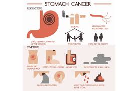 Polyposis is dangerous precisely because it can turn into cancer. Stomach Gastric Cancer Facts Symptoms Diagnosis Treatments