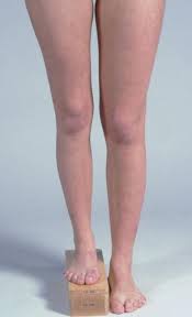 Image result for Functional Leg Length Discrepancy