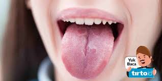 Batuk kering yang terasa baca juga: Covid Tongue Atau Bercak Lidah Jadi Gejala Baru Corona Kata Ahli Tirto Id