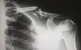 Here are the 10 best states to work in rad techs, or radiology technicians, earn a median annual salary of $59,260. Educational Outlook For Becoming A Radiologist Peterson S
