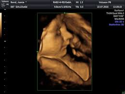 Ultraschall 20.ssw (19+3) junge, outing, its a boy, sonographie, pregnant, baby, schwanger. 3d 4d Ultraschall Babyviewing De Posts Facebook