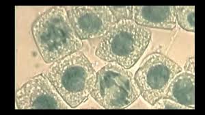 Find content updated daily for cell microscope 1 6 Skill Identifying Stages Of Mitosis Under A Microscope And On A Micrograph Youtube