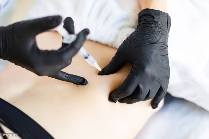 Body Fillers Dubai | Aesthetics International Clinic