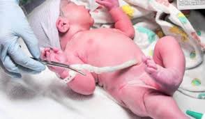 And the way you do the bath will be different depending on. Here S The Proper Way To Clean Your Baby S Umbilical Cord Babymigo