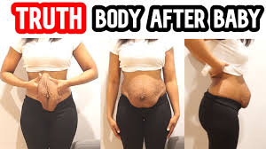 Loose abdominal muscles, extra skin, fat and a relaxed pelvic girdle all help create the hanging belly look after pregnancy. My Body After Pregnancy My Postpartum Body Saggy Skin Body Transformation Journey Sahm Youtube