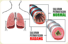 Tanda bayi sukar bernafas perut berombak perlu rawatan segera. Pertahanan Utama Badan Manusia Paru Paru Become Healthy