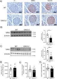 It is a small effect, but modern sensors can pick it up well. Grk2 Regulates Glp 1r Mediated Early Phase Insulin Secretion In Vivo Springerlink