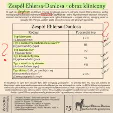 Tkanka łączna jest odpowiedzialna za wsparcie i strukturę skóry, naczyń krwionośnych, kości i narządów. Eds Zespol Ehlersa Danlosa Ehlers Danlos Syndrom Ehlers Danlos Map Map Screenshot