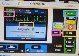 Image result for Synchronized Cardioversion