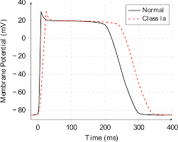 Image result for Antiarrhythmic