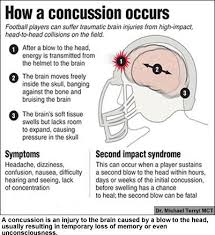 A new series of articles in the journal. Are Smart Mouthguards The Solution To Sports Related Concussions Traumatic Brain Injury Concussions News Articles For Kids