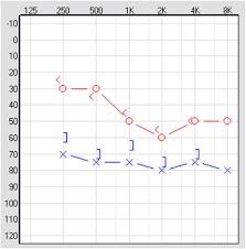 Each ear is represented by a different line on the graph. How To Read Your Audiogram Results