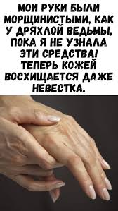 что делать при выпадении волос из за гормонального сбоя Zhenskij Zhurnal V 2020 G Lechenie Ruk Cellyulit Na Nogah Otbelivanie Kozhi