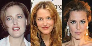I read a book years ago about a hollywood plastic surgeon who was doing Gillian Anderson Plastic Surgery Before And After Pictures 2021