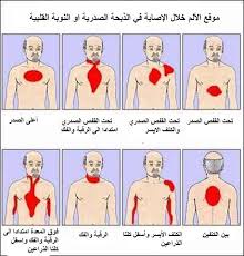 نواعم نت موقع الألم عند الإصابة في النوبة القلبية أو الذبحة الصدرية Nursing Care Cardiac Nursing Nursing Care Plan