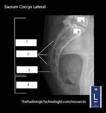 Student Study Guide Sacrum Coccyx Anatomy