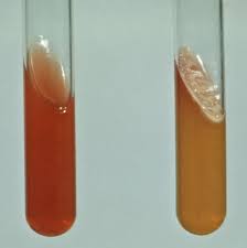 Image result for yersinia fotos