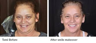 Great Norfolk Dentures Dentist